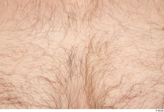 Tomas Salek hairy skin 0001.jpg